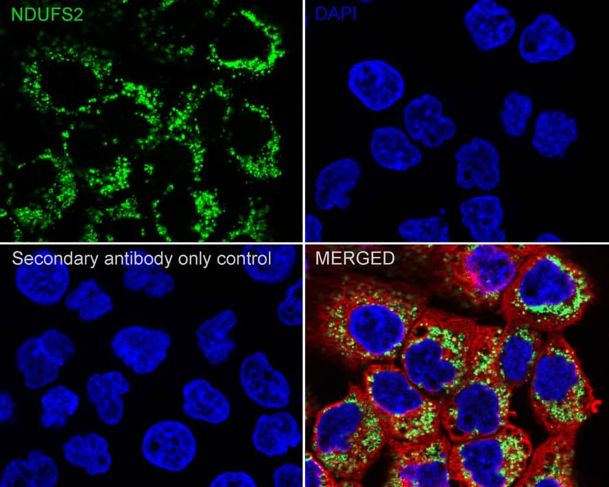 Immunocytochemistry/ Immunofluorescence: NDUFS2 Antibody (PSH03-26) [NBP3-32639] - Immunocytochemistry analysis of A431 cells labeling NDUFS2 with Rabbit anti-NDUFS2 antibody (NBP3-32639) at 1/100 dilution. Cells were fixed in 4% paraformaldehyde for 20 minutes at room temperature, permeabilized with 0.1% Triton X-100 in PBS for 5 minutes at room temperature, then blocked with 1% BSA in 10% negative goat serum for 1 hour at room temperature. Cells were then incubated with Rabbit anti-NDUFS2 antibody (NBP3-32639) at 1/100 dilution in 1% BSA in PBST overnight at 4 ℃. Goat Anti-Rabbit IgG H&L (iFluor™ 488) was used as the secondary antibody at 1/1,000 dilution. PBS instead of the primary antibody was used as the secondary antibody only control. Nuclear DNA was labelled in blue with DAPI. Beta tubulin (red) was stained at 1/100 dilution overnight at +4℃. Goat Anti-Mouse IgG H&L (iFluor™ 594) was used as the secondary antibody at 1/1,000 dilution.