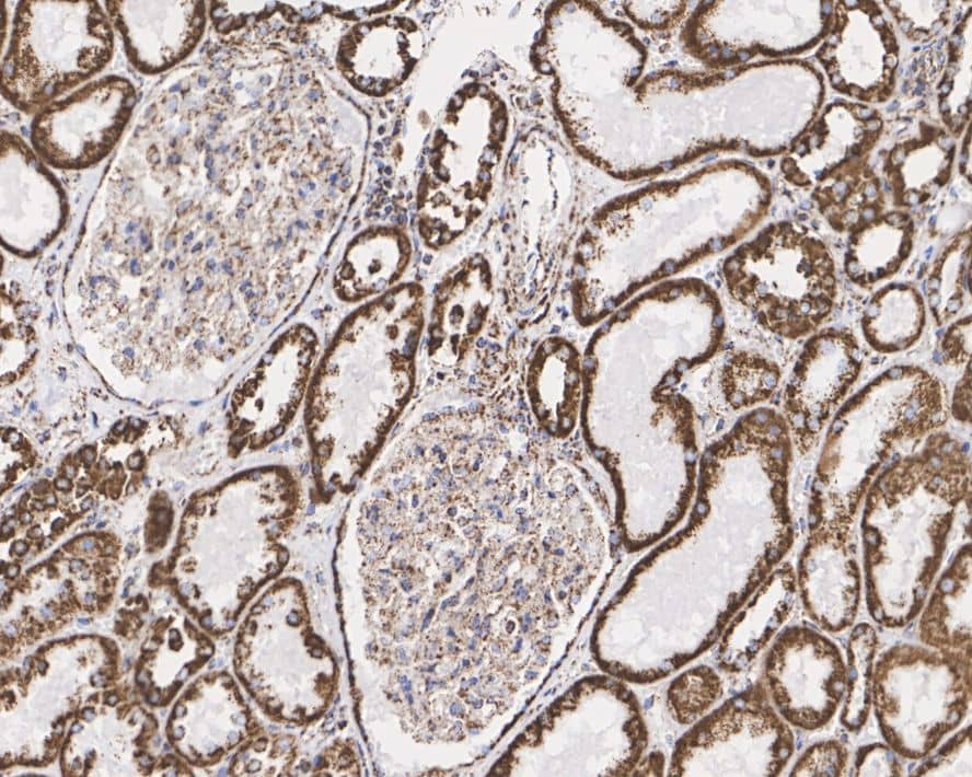 Immunohistochemistry: NDUFS2 Antibody (PSH03-26) [NBP3-32639] - Immunohistochemical analysis of paraffin-embedded human kidney tissue with Rabbit anti-NDUFS2 antibody (NBP3-32639) at 1/1,000 dilution. The section was pre-treated using heat mediated antigen retrieval with Tris-EDTA buffer (pH 9.0) for 20 minutes. The tissues were blocked in 1% BSA for 20 minutes at room temperature, washed with ddH2O and PBS, and then probed with the primary antibody (NBP3-32639) at 1/1,000 dilution for 1 hour at room temperature. The detection was performed using an HRP conjugated compact polymer system. DAB was used as the chromogen. Tissues were counterstained with hematoxylin and mounted with DPX.