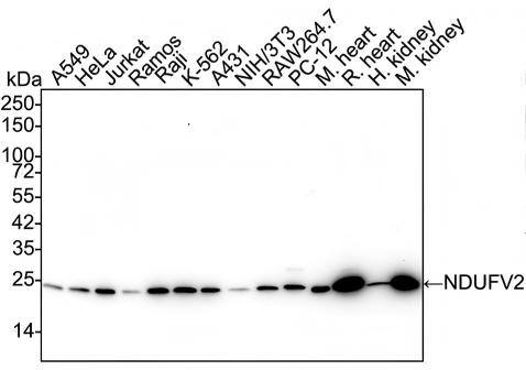 Western blot analysis on different lysates with NBP3-32640 at 1/2,000 dilution and competitor's antibody at 1/1,000 dilution. Lane 1: A549 cell lysate (20 µg/Lane) Lane 2: HeLa cell lysate (20 µg/Lane) Lane 3: Jurkat cell lysate (20 µg/Lane) Lane 4: Ramos cell lysate (20 µg/Lane) Lane 5: Raji cell lysate (20 µg/Lane) Lane 6: K-562 cell lysate (20 µg/Lane) Lane 7: A431 cell lysate (20 µg/Lane) Lane 8: NIH/3T3 cell lysate (20 µg/Lane) Lane 9: RAW264.7 cell lysate (20 µg/Lane) Lane 10: PC-12 cell lysate (20 µg/Lane) Lane 11: Mouse heart tissue lysate (40 µg/Lane) Lane 12: Rat heart tissue lysate (40 µg/Lane) Lane 13: Human kidney tissue lysate (40 µg/Lane) Lane 14: Mouse kidney tissue lysate (40 µg/Lane) Predicted band size: 27 kDa Observed band size: 24 kDa Exposure time: 1 minute 59 seconds;  4-20% SDS-PAGE gel. Proteins were transferred to a PVDF membrane and blocked with 5% NFDM/TBST for 1 hour at room temperature. NBP3-32640 at 1/2,000 dilution and competitor's antibody at 1/1,000 dilution were used in 5% NFDM/TBST at 4℃ overnight. Goat Anti-Rabbit IgG [HRP] Secondary Antibody at 1/50,000 dilution was used for 1 hour at room temperature.