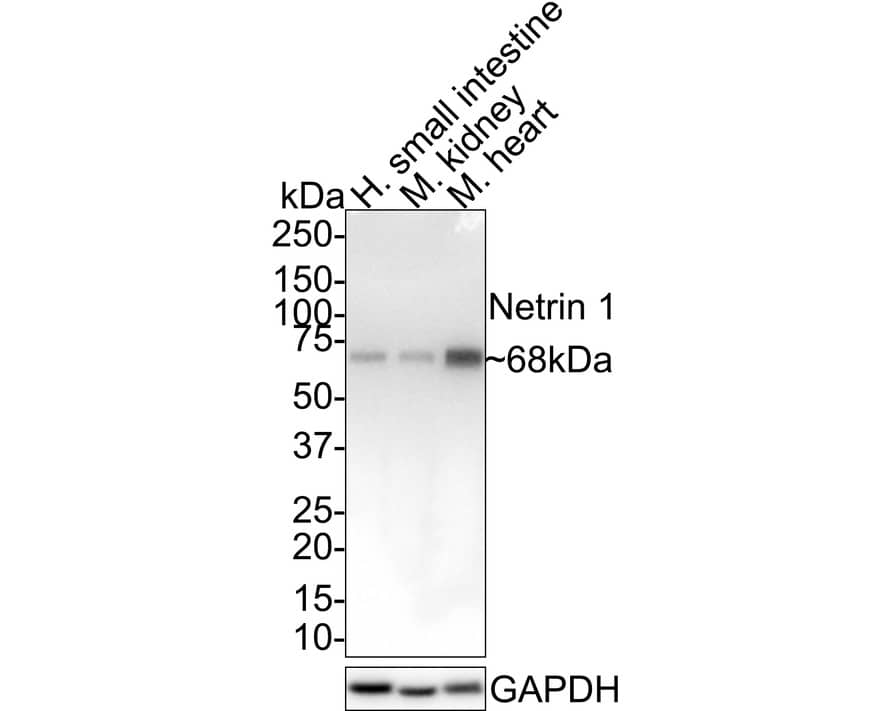 Western blot analysis on different lysates with NBP3-32643 at 1/1,000 dilution. Lane 1: Human small intestine tissue lysate Lane 2: Mouse kidney tissue lysate Lane 3: Mouse heart tissue lysate Lysates/proteins at 40 µg/Lane. Predicted band size: 68 kDa Observed band size: 68 kDa Exposure time: 2 minutes; 4-20% SDS-PAGE gel. Proteins were transferred to a PVDF membrane and blocked with 5% NFDM/TBST for 1 hour at room temperature. NBP3-32643 at 1/1,000 dilution was used in 5% NFDM/TBST at 4℃ overnight. Goat Anti-Rabbit IgG [HRP] Secondary Antibody at 1:100,000 dilution was used for 1 hour at room temperature.