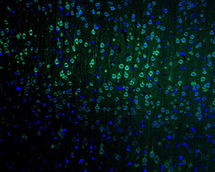 Immunohistochemistry: Neurogranin Antibody (PSH02-96) [NBP3-32645] - Immunofluorescence analysis of paraffin-embedded rat brain tissue labeling Neurogranin with Rabbit anti-Neurogranin antibody (NBP3-32645) at 1/50 dilution. The section was pre-treated using heat mediated antigen retrieval with Tris-EDTA buffer (pH 9.0) for 20 minutes. The tissues were blocked in 10% negative goat serum for 1 hour at room temperature, washed with PBS, and then probed with the primary antibody (NBP3-32645, green) at 1/50 dilution overnight at 4 ℃, washed with PBS. Goat Anti-Rabbit IgG H&L (iFluor™ 488) was used as the secondary antibody at 1/1,000 dilution. Nuclei were counterstained with DAPI (blue).