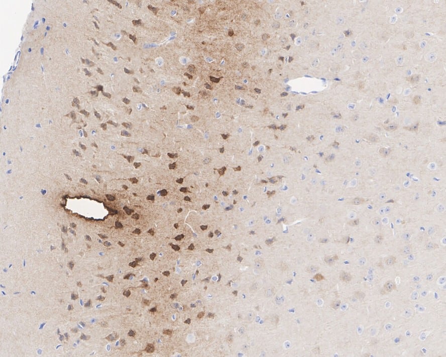 Immunohistochemistry: Neurogranin Antibody (PSH02-96) [NBP3-32645] - Immunohistochemical analysis of paraffin-embedded mouse brain tissue with Rabbit anti-Neurogranin antibody (NBP3-32645) at 1/500 dilution. The section was pre-treated using heat mediated antigen retrieval with Tris-EDTA buffer (pH 9.0) for 20 minutes. The tissues were blocked in 1% BSA for 20 minutes at room temperature, washed with ddH2O and PBS, and then probed with the primary antibody (NBP3-32645) at 1/500 dilution for 1 hour at room temperature. The detection was performed using an HRP conjugated compact polymer system. DAB was used as the chromogen. Tissues were counterstained with hematoxylin and mounted with DPX.