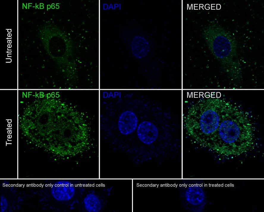 Immunocytochemistry/ Immunofluorescence: RelA/NFkB p65 Antibody (PSH0-27) [NBP3-32648] - Immunocytochemistry analysis of NIH/3T3 cells treated with or without 50μg/mL TNF-alpha  for 20 minutes labeling RelA/NFkB p65 with Rabbit anti-RelA/NFkB p65 antibody (NBP3-32648) at 1/200 dilution. Cells were fixed in 4% paraformaldehyde for 10 minutes at 37 ℃, permeabilized with 0.05% Triton X-100 in PBS for 20 minutes, and then blocked with 2% negative goat serum for 30 minutes at room temperature. Cells were then incubated with Rabbit anti-RelA/NFkB p65 antibody (NBP3-32648) at 1/200 dilution in 2% negative goat serum overnight at 4 ℃. Goat Anti-Rabbit IgG H&L (iFluor™ 488) was used as the secondary antibody at 1/1,000 dilution. PBS instead of the primary antibody was used as the secondary antibody only control. Nuclear DNA was labelled in blue with DAPI.