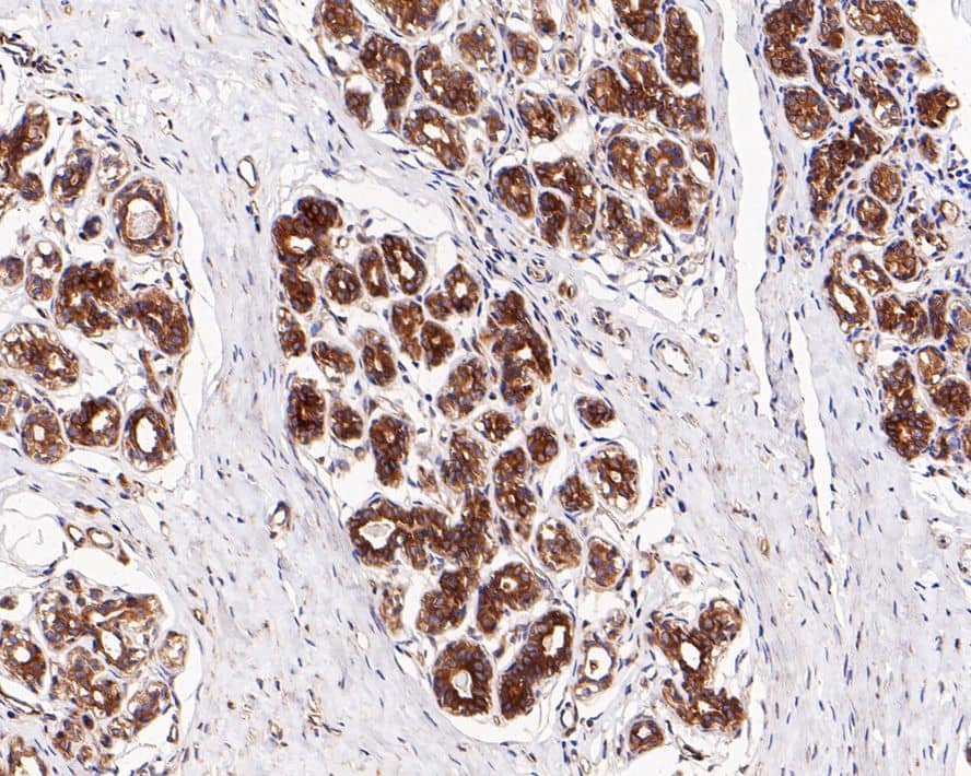 Immunohistochemistry: RelA/NFkB p65 Antibody (PSH0-27) [NBP3-32648] - Immunohistochemical analysis of paraffin-embedded human breast tissue with Rabbit anti-RelA/NFkB p65 antibody (NBP3-32648) at 1/1,000 dilution. The section was pre-treated using heat mediated antigen retrieval with Tris-EDTA buffer (pH 9.0) for 20 minutes. The tissues were blocked in 1% BSA for 20 minutes at room temperature, washed with ddH2O and PBS, and then probed with the primary antibody (NBP3-32648) at 1/1,000 dilution for 1 hour at room temperature. The detection was performed using an HRP conjugated compact polymer system. DAB was used as the chromogen. Tissues were counterstained with hematoxylin and mounted with DPX.