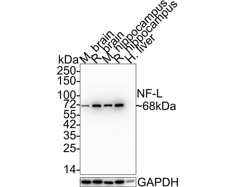 Western Blot: NF-L Antibody (PSH0-77) [NBP3-32649] - Western blot analysis of NF-L on different lysates with Rabbit anti-NF-L antibody (NBP3-32649) at 1/1,000 dilution. Lane 1: Mouse brain tissue lysate Lane 2: Rat brain tissue lysate Lane 3: Mouse hippocampus tissue lysate Lane 4: Rat hippocampus tissue lysate Lane 5: Human liver tissue lysate (negative) Lysates/proteins at 20 ug/Lane. Predicted band size: 62 kDa Observed band size: 68 kDa Exposure time: 1 minute 2 seconds; 4-20% SDS-PAGE gel. Proteins were transferred to a PVDF membrane and blocked with 5% NFDM/TBST for 1 hour at room temperature. The primary antibody (NBP3-32649) at 1/1,000 dilution was used in 5% NFDM/TBST at 4  overnight. Goat Anti-Rabbit IgG - HRP Secondary Antibody at 1:100,000 dilution was used for 1 hour at room temperature.