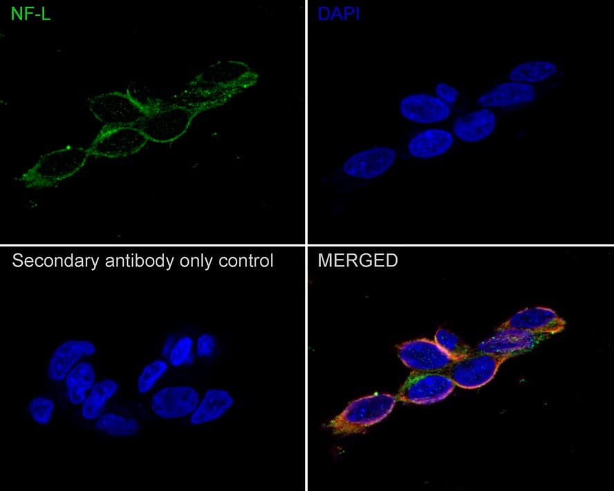 Immunocytochemistry/ Immunofluorescence: NF-L Antibody (PSH0-77) [NBP3-32649] - Immunocytochemistry analysis of SH-SY5Y cells labeling NF-L with Rabbit anti-NF-L antibody (NBP3-32649) at 1/200 dilution. Cells were fixed in 4% paraformaldehyde for 20 minutes at room temperature, permeabilized with 0.1% Triton X-100 in PBS for 5 minutes at room temperature, then blocked with 1% BSA in 10% negative goat serum for 1 hour at room temperature. Cells were then incubated with Rabbit anti-NF-L antibody (NBP3-32649) at 1/200 dilution in 1% BSA in PBST overnight at 4 ℃. Goat Anti-Rabbit IgG H&L (iFluor™ 488) was used as the secondary antibody at 1/1,000 dilution. PBS instead of the primary antibody was used as the secondary antibody only control. Nuclear DNA was labelled in blue with DAPI. Beta tubulin (red) was stained at 1/100 dilution overnight at +4℃. Goat Anti-Mouse IgG H&L (iFluor™ 594) was used as the secondary antibody at 1/1,000 dilution.
