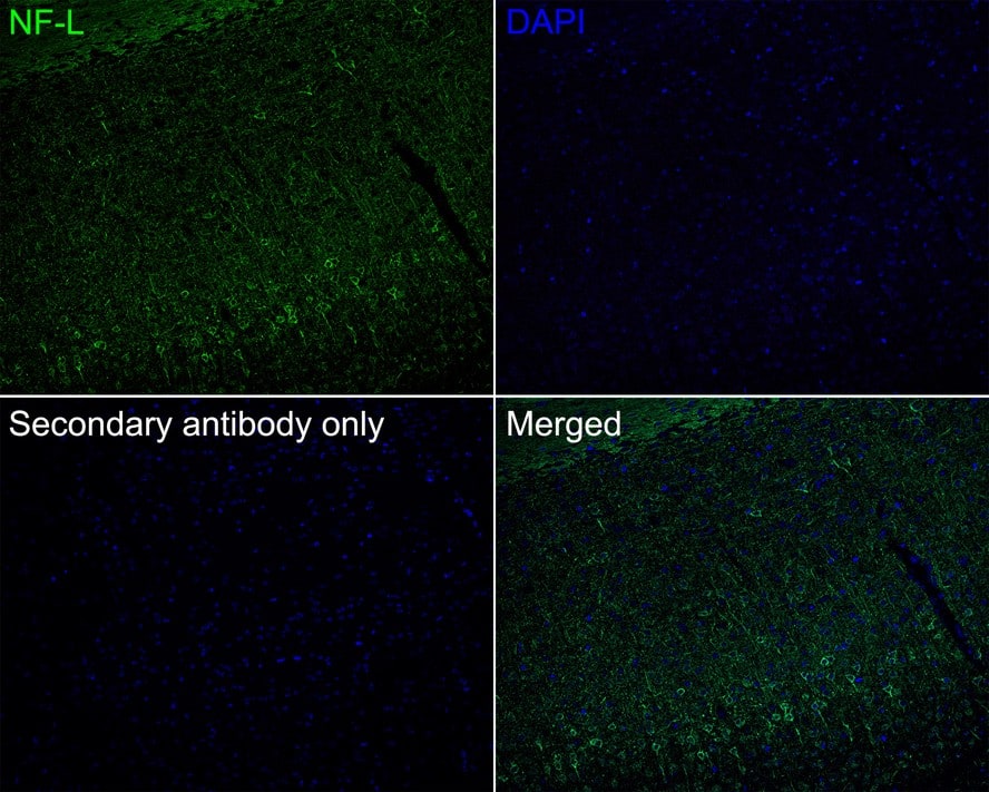 Immunohistochemistry: NF-L Antibody (PSH0-77) [NBP3-32649] - Immunofluorescence analysis of paraffin-embedded mouse brain tissue labeling NF-L with Rabbit anti-NF-L antibody (NBP3-32649) at 1/200 dilution. The section was pre-treated using heat mediated antigen retrieval with Tris-EDTA buffer (pH 9.0) for 20 minutes. The tissues were blocked in 10% negative goat serum for 1 hour at room temperature, washed with PBS, and then probed with the primary antibody (NBP3-32649, green) at 1/200 dilution overnight at 4 ℃, washed with PBS. Goat Anti-Rabbit IgG H&L (iFluor™ 488) was used as the secondary antibody at 1/1,000 dilution. Nuclei were counterstained with DAPI (blue).