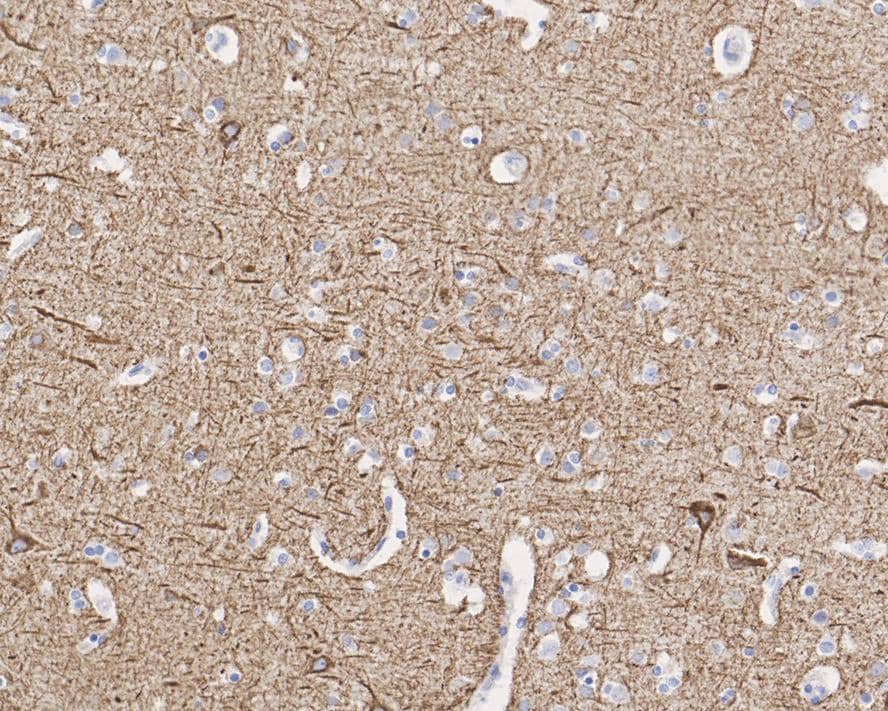 Immunohistochemistry: NF-L Antibody (PSH0-77) [NBP3-32649] - Immunohistochemical analysis of paraffin-embedded human brain tissue with Rabbit anti-NF-L antibody (NBP3-32649) at 1/2,000 dilution. The section was pre-treated using heat mediated antigen retrieval with Tris-EDTA buffer (pH 9.0) for 20 minutes. The tissues were blocked in 1% BSA for 20 minutes at room temperature, washed with ddH2O and PBS, and then probed with the primary antibody (NBP3-32649) at 1/2,000 dilution for 1 hour at room temperature. The detection was performed using an HRP conjugated compact polymer system. DAB was used as the chromogen. Tissues were counterstained with hematoxylin and mounted with DPX.