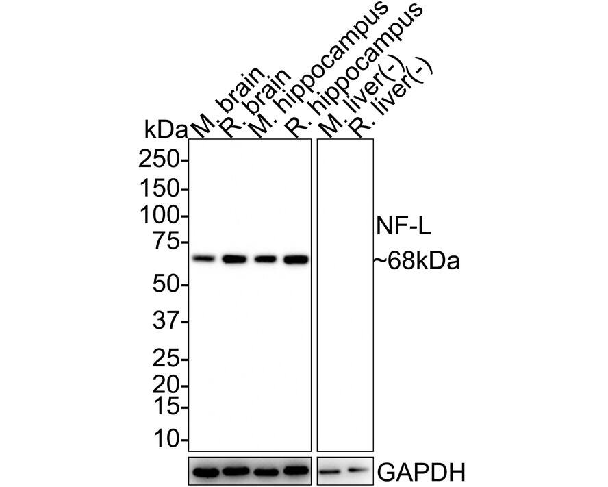 Western blot analysis on different lysates with NBP3-32650 at 1/1,000 dilution. Lane 1: Mouse brain tissue lysate Lane 2: Rat brain tissue lysate Lane 3: Mouse hippocampus tissue lysate Lane 4: Rat hippocampus tissue lysate Lane 5: Mouse liver tissue lysate (negative) Lane 6: Rat liver tissue lysate (negative) Lysates/proteins at 20 µg/Lane. Predicted band size: 62 kDa Observed band size: 68 kDa Exposure time: 3 minutes; 4-20% SDS-PAGE gel. Proteins were transferred to a PVDF membrane and blocked with 5% NFDM/TBST for 1 hour at room temperature. NBP3-32650 at 1/1,000 dilution was used in 5% NFDM/TBST at room temperature for 2 hours. Goat Anti-Rabbit IgG [HRP] Secondary Antibody at 1:100,000 dilution was used for 1 hour at room temperature.