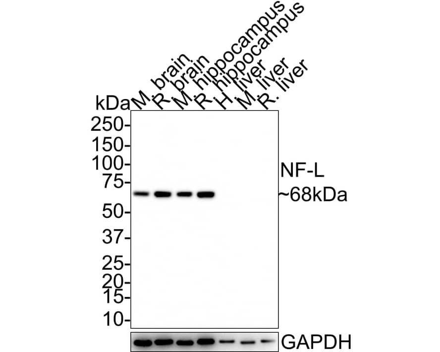 Western Blot: NF-L Antibody (PS02-10) [NBP3-32650] - Western blot analysis of NF-L on different lysates with Rabbit anti-NF-L antibody (NBP3-32650) at 1/1,000 dilution. Lane 1: Mouse brain tissue lysate Lane 2: Rat brain tissue lysate Lane 3: Mouse hippocampus tissue lysate Lane 4: Rat hippocampus tissue lysate Lane 5: Human liver tissue lysate (negative) Lane 6: Mouse liver tissue lysate (negative) Lane 7: Rat liver tissue lysate (negative) Lysates/proteins at 20 ug/Lane. Predicted band size: 62 kDa Observed band size: 68 kDa Exposure time: 3 minutes; 4-20% SDS-PAGE gel. Proteins were transferred to a PVDF membrane and blocked with 5% NFDM/TBST for 1 hour at room temperature. The primary antibody (NBP3-32650) at 1/1,000 dilution was used in 5% NFDM/TBST at room temperature for 2 hours. Goat Anti-Rabbit IgG - HRP Secondary Antibody at 1:100,000 dilution was used for 1 hour at room temperature.