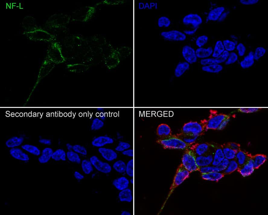 Immunocytochemistry/ Immunofluorescence: NF-L Antibody (PS02-10) [NBP3-32650] - Immunocytochemistry analysis of SH-SY5Y cells labeling NF-L with Rabbit anti-NF-L antibody (NBP3-32650) at 1/100 dilution. Cells were fixed in 4% paraformaldehyde for 20 minutes at room temperature, permeabilized with 0.1% Triton X-100 in PBS for 5 minutes at room temperature, then blocked with 1% BSA in 10% negative goat serum for 1 hour at room temperature. Cells were then incubated with Rabbit anti-NF-L antibody (NBP3-32650) at 1/100 dilution in 1% BSA in PBST overnight at 4 ℃. Goat Anti-Rabbit IgG H&L (iFluor™ 488) was used as the secondary antibody at 1/1,000 dilution. PBS instead of the primary antibody was used as the secondary antibody only control. Nuclear DNA was labelled in blue with DAPI. Beta tubulin (red) was stained at 1/100 dilution overnight at +4℃. Goat Anti-Mouse IgG H&L (iFluor™ 594) was used as the secondary antibody at 1/1,000 dilution.