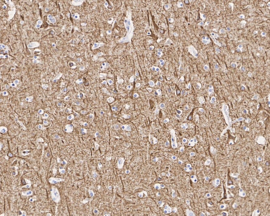 Immunohistochemistry: NF-L Antibody (PS02-10) [NBP3-32650] - Immunohistochemical analysis of paraffin-embedded human brain tissue with Rabbit anti-NF-L antibody (NBP3-32650) at 1/1,000 dilution. The section was pre-treated using heat mediated antigen retrieval with Tris-EDTA buffer (pH 9.0) for 20 minutes. The tissues were blocked in 1% BSA for 20 minutes at room temperature, washed with ddH2O and PBS, and then probed with the primary antibody (NBP3-32650) at 1/1,000 dilution for 1 hour at room temperature. The detection was performed using an HRP conjugated compact polymer system. DAB was used as the chromogen. Tissues were counterstained with hematoxylin and mounted with DPX.