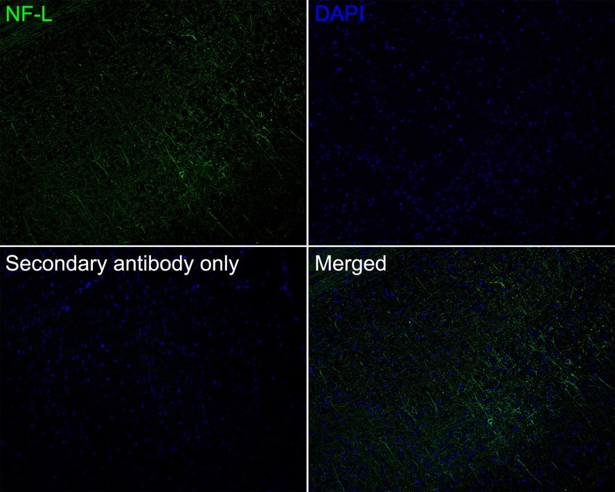 Immunohistochemistry: NF-L Antibody (PS02-10) [NBP3-32650] - Immunofluorescence analysis of paraffin-embedded mouse brain tissue labeling NF-L with Rabbit anti-NF-L antibody (NBP3-32650) at 1/200 dilution. The section was pre-treated using heat mediated antigen retrieval with Tris-EDTA buffer (pH 9.0) for 20 minutes. The tissues were blocked in 10% negative goat serum for 1 hour at room temperature, washed with PBS, and then probed with the primary antibody (NBP3-32650, green) at 1/200 dilution overnight at 4 ℃, washed with PBS. Goat Anti-Rabbit IgG H&L (iFluor™ 488) was used as the secondary antibody at 1/1,000 dilution. Nuclei were counterstained with DAPI (blue).