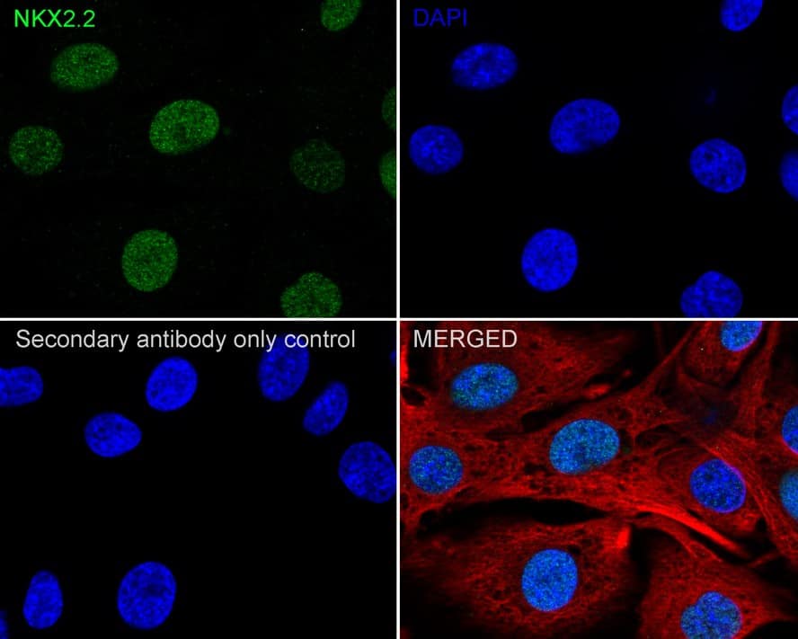 Immunocytochemistry/ Immunofluorescence: NKX2.2 Antibody (JE60-66) [NBP3-32654] - Immunocytochemistry analysis of C6 cells labeling NKX2.2 with Rabbit anti-NKX2.2 antibody (NBP3-32654) at 1/100 dilution. Cells were fixed in 4% paraformaldehyde for 20 minutes at room temperature, permeabilized with 0.1% Triton X-100 in PBS for 5 minutes at room temperature, then blocked with 1% BSA in 10% negative goat serum for 1 hour at room temperature. Cells were then incubated with Rabbit anti-NKX2.2 antibody (NBP3-32654) at 1/100 dilution in 1% BSA in PBST overnight at 4 ℃. Goat Anti-Rabbit IgG H&L (iFluor™ 488) was used as the secondary antibody at 1/1,000 dilution. PBS instead of the primary antibody was used as the secondary antibody only control. Nuclear DNA was labelled in blue with DAPI. Beta tubulin (red) was stained at 1/100 dilution overnight at +4℃. Goat Anti-Mouse IgG H&L (iFluor™ 594) was used as the secondary antibody at 1/1,000 dilution.