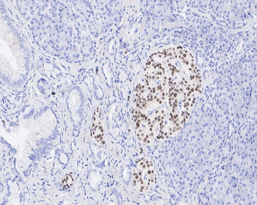 Immunohistochemistry: NKX2.2 Antibody (JE60-66) [NBP3-32654] - Immunohistochemical analysis of paraffin-embedded human pancreas tissue with Rabbit anti-NKX2.2 antibody (NBP3-32654) at 1/1,000 dilution. The section was pre-treated using heat mediated antigen retrieval with sodium citrate buffer (pH 6.0) for 2 minutes. The tissues were blocked in 1% BSA for 20 minutes at room temperature, washed with ddH2O and PBS, and then probed with the primary antibody (NBP3-32654) at 1/1,000 dilution for 1 hour at room temperature. The detection was performed using an HRP conjugated compact polymer system. DAB was used as the chromogen. Tissues were counterstained with hematoxylin and mounted with DPX.