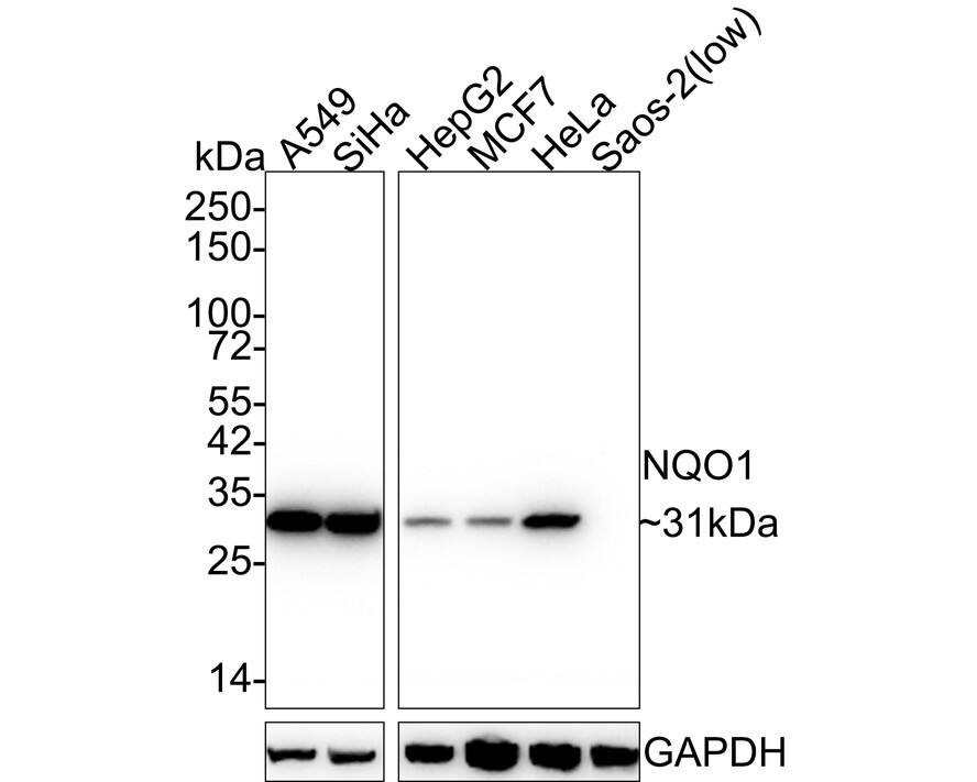 Western blot analysis on different lysates with NBP3-32659 at 1/2,000 dilution. Lane 1: A549 cell lysate Lane 2: SiHa cell lysate Lane 3: HepG2 cell lysate Lane 4: MCF7 cell lysate Lane 5: HeLa cell lysate Lane 6: Saos-2 cell lysate (low expression) Lysates/proteins at 30 µg/Lane. Predicted band size: 31 kDa Observed band size: 31 kDa Exposure time: 24 seconds; 4-20% SDS-PAGE gel. Proteins were transferred to a PVDF membrane and blocked with 5% NFDM/TBST for 1 hour at room temperature. NBP3-32659 at 1/2,000 dilution was used in 5% NFDM/TBST at 4℃ overnight. Goat anti-Mouse IgG [HRP] at 1/50,000 dilution was used for 1 hour at room temperature.