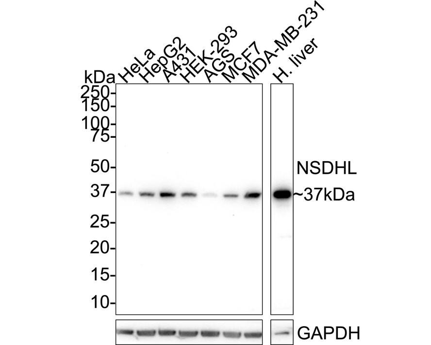 Western blot analysis on different lysates with NBP3-32662 at 1/1,000 dilution. Lane 1: HeLa cell lysate Lane 2: HepG2 cell lysate Lane 3: A431 cell lysate Lane 4: HEK-293 cell lysate Lane 5: AGS cell lysate Lane 6: MCF7 cell lysate Lane 7: MDA-MB-231 cell lysate Lane 8: Human liver tissue lysate Lysates/proteins at 30 µg/Lane. Predicted band size: 42 kDa Observed band size: 37 kDa Exposure time: 3 minutes 22 seconds; 4-20% SDS-PAGE gel. Proteins were transferred to a PVDF membrane and blocked with 5% NFDM/TBST for 1 hour at room temperature. NBP3-32662 at 1/1,000 dilution was used in 5% NFDM/TBST at 4℃ overnight. Goat Anti-Rabbit IgG [HRP] Secondary Antibody at 1/50,000 dilution was used for 1 hour at room temperature.