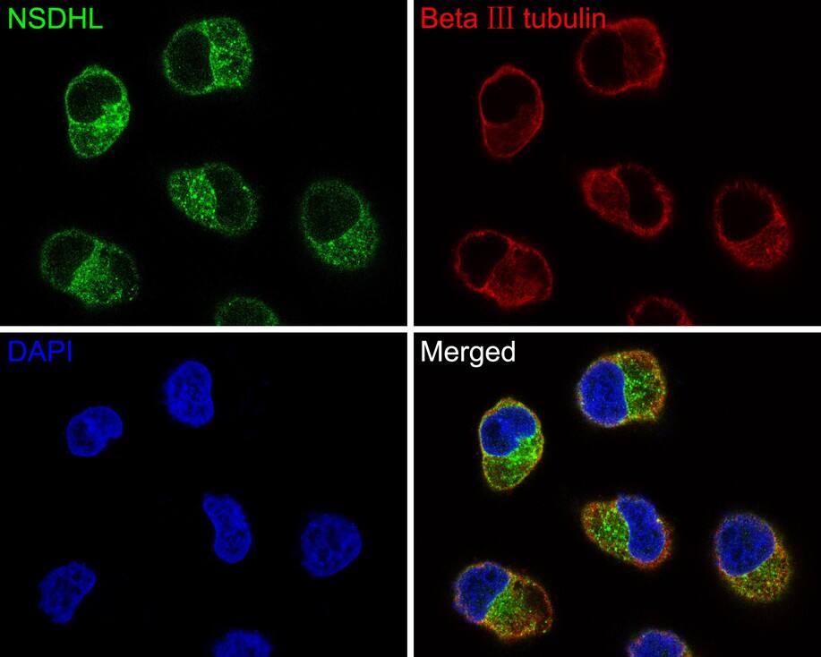 Immunocytochemistry/ Immunofluorescence: NSDHL Antibody (JE64-86) [NBP3-32662] - Immunocytochemistry analysis of Hela cells labeling NSDHL with Rabbit anti-NSDHL antibody (NBP3-32662) at 1/200 dilution. Cells were fixed in 4% paraformaldehyde for 10 minutes at 37 ℃, permeabilized with 0.05% Triton X-100 in PBS for 20 minutes, and then blocked with 2% negative goat serum for 30 minutes at room temperature. Cells were then incubated with Rabbit anti-NSDHL antibody (NBP3-32662) at 1/200 dilution in 2% negative goat serum overnight at 4 ℃. Goat Anti-Rabbit IgG H&L (Alexa Fluor® 488) was used as the secondary antibody at 1/1,000 dilution. Nuclear DNA was labelled in blue with DAPI. Beta Ⅲ tubulin (M0805-8, red) was stained at 1/200 dilution overnight at +4℃. Goat Anti-Mouse IgG H&L (Alexa Fluor® 647) were used as the secondary antibody at 1/1,000 dilution.