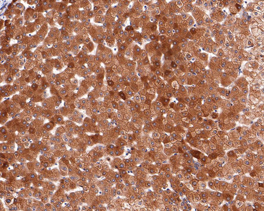 Immunohistochemistry: NSDHL Antibody (JE64-86) [NBP3-32662] - Immunohistochemical analysis of paraffin-embedded human liver tissue with Rabbit anti-NSDHL antibody (NBP3-32662) at 1/400 dilution. The section was pre-treated using heat mediated antigen retrieval with Tris-EDTA buffer (pH 9.0) for 20 minutes. The tissues were blocked in 1% BSA for 20 minutes at room temperature, washed with ddH2O and PBS, and then probed with the primary antibody (NBP3-32662) at 1/400 dilution for 1 hour at room temperature. The detection was performed using an HRP conjugated compact polymer system. DAB was used as the chromogen. Tissues were counterstained with hematoxylin and mounted with DPX.