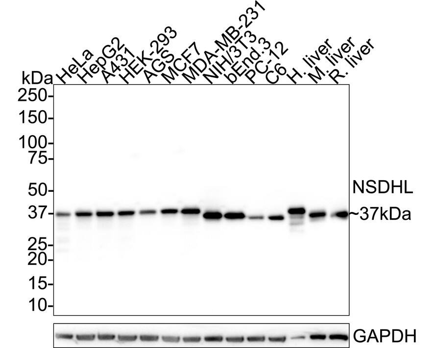 Western Blot NSDHL Antibody (PSH02-36)