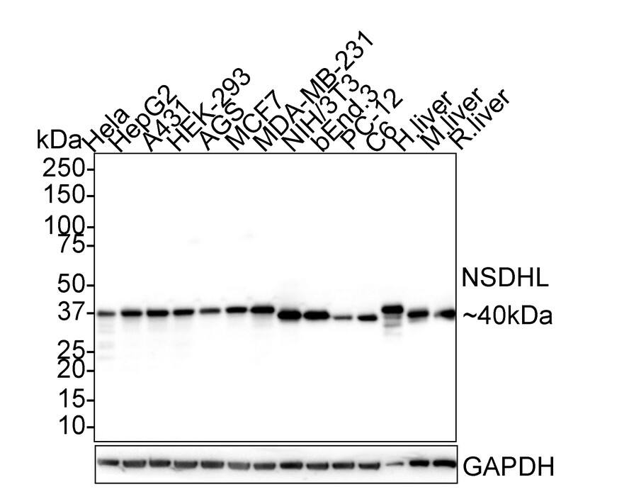 Western Blot: NSDHL Antibody (PSH02-36) [NBP3-32663] - Western blot analysis of NSDHL on different lysates with Rabbit anti-NSDHL antibody (NBP3-32663) at 1/1,000 dilution. Lane 1: HeLa cell lysate Lane 2: HepG2 cell lysate Lane 3: A431 cell lysate Lane 4: HEK-293 cell lysate Lane 5: AGS cell lysate Lane 6: MCF7 cell lysate  Lane 7: MDA-MB-231 cell lysate Lane 8: NIH/3T3 cell lysate Lane 9: bEnd.3 cell lysate Lane 10: PC-12 cell lysate Lane 11: C6 cell lysate Lane 12: Human liver tissue lysate Lane 13: Mouse liver tissue lysate Lane 14: Rat liver tissue lysate Lysates/proteins at 30 ug/Lane. Predicted band size: 42 kDa Observed band size: 40 kDa Exposure time: 42 seconds; 4-20% SDS-PAGE gel. Proteins were transferred to a PVDF membrane and blocked with 5% NFDM/TBST for 1 hour at room temperature. The primary antibody (NBP3-32663) at 1/1,000 dilution was used in 5% NFDM/TBST at 4  overnight. Goat Anti-Rabbit IgG - HRP Secondary Antibody at 1/50,000 dilution was used for 1 hour at room temperature.