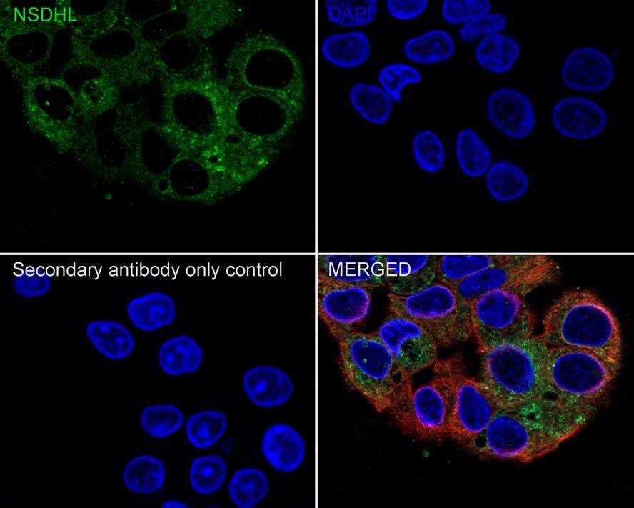 Immunocytochemistry/ Immunofluorescence: NSDHL Antibody (PSH02-36) [NBP3-32663] - Immunocytochemistry analysis of HepG2 cells labeling NSDHL with Rabbit anti-NSDHL antibody (NBP3-32663) at 1/100 dilution. Cells were fixed in 4% paraformaldehyde for 20 minutes at room temperature, permeabilized with 0.1% Triton X-100 in PBS for 5 minutes at room temperature, then blocked with 1% BSA in 10% negative goat serum for 1 hour at room temperature. Cells were then incubated with Rabbit anti-NSDHL antibody (NBP3-32663) at 1/100 dilution in 1% BSA in PBST overnight at 4 ℃. Goat Anti-Rabbit IgG H&L (iFluor™ 488) was used as the secondary antibody at 1/1,000 dilution. PBS instead of the primary antibody was used as the secondary antibody only control. Nuclear DNA was labelled in blue with DAPI. Beta tubulin (red) was stained at 1/100 dilution overnight at +4℃. Goat Anti-Mouse IgG H&L (iFluor™ 594) was used as the secondary antibody at 1/1,000 dilution.