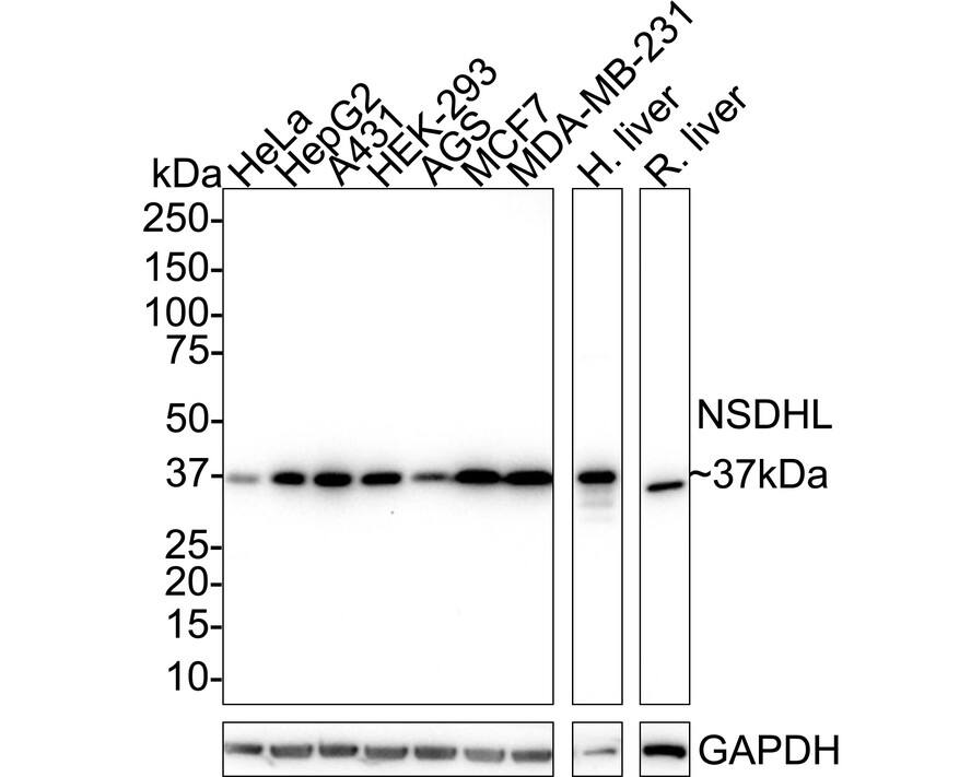 Western blot analysis on different lysates with NBP3-32664 at 1/1,000 dilution. Lane 1: HeLa cell lysate Lane 2: HepG2 cell lysate Lane 3: A431 cell lysate Lane 4: HEK-293 cell lysate Lane 5: AGS cell lysate Lane 6: MCF7 cell lysate Lane 7: MDA-MB cell lysate Lane 8: Human liver tissue lysate Lane 9: Rat liver tissue lysate Lysates/proteins at 30 µg/Lane. Predicted band size: 42 kDa Observed band size: 37 kDa Exposure time: 3 minutes 22 seconds; 4-20% SDS-PAGE gel. Proteins were transferred to a PVDF membrane and blocked with 5% NFDM/TBST for 1 hour at room temperature. NBP3-32664 at 1/1,000 dilution was used in 5% NFDM/TBST at 4℃ overnight. Goat Anti-Rabbit IgG [HRP] Secondary Antibody at 1/50,000 dilution was used for 1 hour at room temperature.