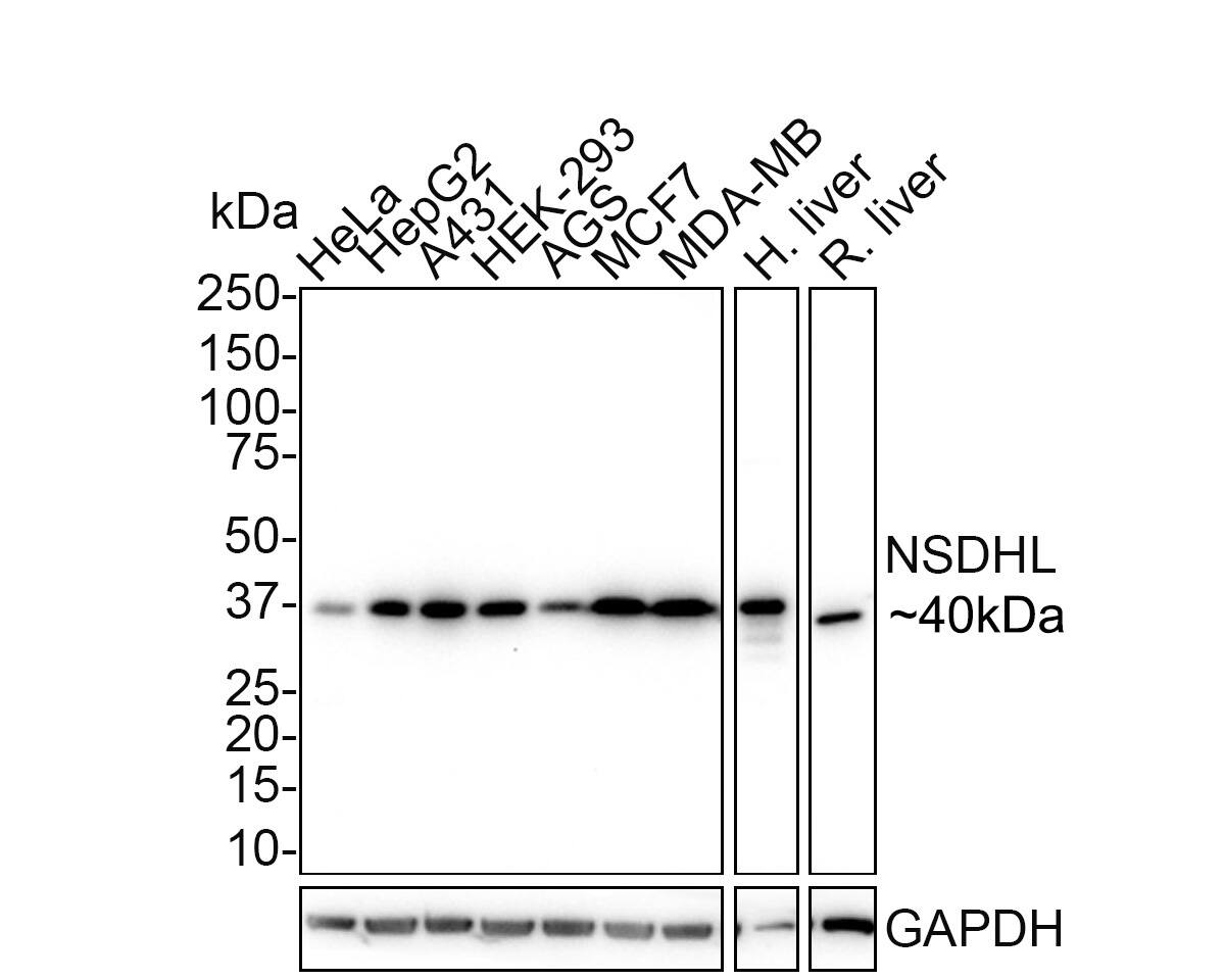 Western Blot: NSDHL Antibody (PSH02-37) [NBP3-32664] - Western blot analysis of NSDHL on different lysates with Rabbit anti-NSDHL antibody (NBP3-32664) at 1/1,000 dilution. Lane 1: HeLa cell lysate Lane 2: HepG2 cell lysate Lane 3: A431 cell lysate Lane 4: HEK-293 cell lysate Lane 5: AGS cell lysate Lane 6: MCF7 cell lysate Lane 7: MDA-MB cell lysate Lane 8: Human liver tissue lysate Lane 9: Rat liver tissue lysate Lysates/proteins at 30 ug/Lane. Predicted band size: 42 kDa Observed band size: 40 kDa Exposure time: 3 minutes 22 seconds; 4-20% SDS-PAGE gel. Proteins were transferred to a PVDF membrane and blocked with 5% NFDM/TBST for 1 hour at room temperature. The primary antibody (NBP3-32664) at 1/1,000 dilution was used in 5% NFDM/TBST at 4  overnight. Goat Anti-Rabbit IgG - HRP Secondary Antibody at 1/50,000 dilution was used for 1 hour at room temperature.