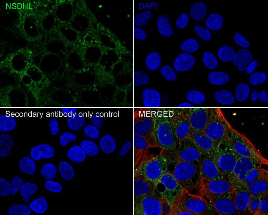 Immunocytochemistry/ Immunofluorescence: NSDHL Antibody (PSH02-37) [NBP3-32664] - Immunocytochemistry analysis of HepG2 cells labeling NSDHL with Rabbit anti-NSDHL antibody (NBP3-32664) at 1/100 dilution. Cells were fixed in 4% paraformaldehyde for 20 minutes at room temperature, permeabilized with 0.1% Triton X-100 in PBS for 5 minutes at room temperature, then blocked with 1% BSA in 10% negative goat serum for 1 hour at room temperature. Cells were then incubated with Rabbit anti-NSDHL antibody (NBP3-32664) at 1/100 dilution in 1% BSA in PBST overnight at 4 ℃. Goat Anti-Rabbit IgG H&L (iFluor™ 488) was used as the secondary antibody at 1/1,000 dilution. PBS instead of the primary antibody was used as the secondary antibody only control. Nuclear DNA was labelled in blue with DAPI. Beta tubulin (red) was stained at 1/100 dilution overnight at +4℃. Goat Anti-Mouse IgG H&L (iFluor™ 594) was used as the secondary antibody at 1/1,000 dilution.