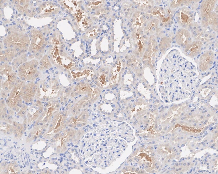 Immunohistochemistry NSUN3 Antibody (PSH01-97)