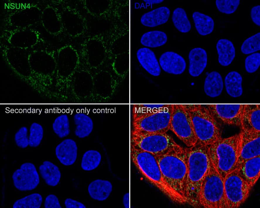 Immunocytochemistry/ Immunofluorescence: NSUN4 Antibody (4G3-R) [NBP3-32666] - Immunocytochemistry analysis of MCF7 cells labeling NSUN4 with Mouse anti-NSUN4 antibody (NBP3-32666) at 1/100 dilution. Cells were fixed in 4% paraformaldehyde for 20 minutes at room temperature, permeabilized with 0.1% Triton X-100 in PBS for 5 minutes at room temperature, then blocked with 1% BSA in 10% negative goat serum for 1 hour at room temperature. Cells were then incubated with Mouse anti-NSUN4 antibody (NBP3-32666) at 1/100 dilution in 1% BSA in PBST overnight at 4 ℃. Goat Anti-Mouse IgG H&L (iFluor™ 488) was used as the secondary antibody at 1/1,000 dilution. PBS instead of the primary antibody was used as the secondary antibody only control. Nuclear DNA was labelled in blue with DAPI. beta Tubulin (red) was stained at 1/100 dilution overnight at +4℃. Goat Anti-Rabbit IgG H&L (iFluor™ 594) were used as the secondary antibody at 1/1,000 dilution.