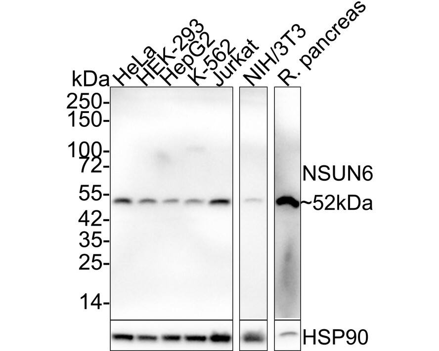 Western blot analysis on different lysates with NBP3-32667 at 1/2,000 dilution. Lane 1: HeLa cell lysate Lane 2: HEK-293 cell lysate Lane 3: HepG2 cell lysate Lane 4: K-562 cell lysate Lane 5: Jurkat cell lysate Lane 6: NIH/3T3 cell lysate Lane 7: Rat pancreas tissue lysate Lysates/proteins at 20 µg/Lane. Predicted band size: 52 kDa Observed band size: 52 kDa Exposure time: 1 minute 58 seconds; 4-20% SDS-PAGE gel. Proteins were transferred to a PVDF membrane and blocked with 5% NFDM/TBST for 1 hour at room temperature. NBP3-32667 at 1/2,000 dilution was used in 5% NFDM/TBST at 4℃ overnight. Goat Anti-Rabbit IgG [HRP] Secondary Antibody at 1/50,000 dilution was used for 1 hour at room temperature.