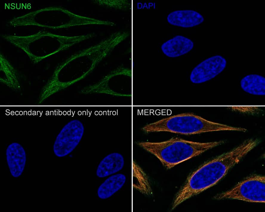 Immunocytochemistry/ Immunofluorescence: NSUN6 Antibody (PSH02-80) [NBP3-32667] - Immunocytochemistry analysis of HeLa cells labeling NSUN6 with Rabbit anti-NSUN6 antibody (NBP3-32667) at 1/100 dilution. Cells were fixed in 100% precooled methanol for 5 minutes at room temperature, then blocked with 1% BSA in 10% negative goat serum for 1 hour at room temperature. Cells were then incubated with Rabbit anti-NSUN6 antibody (NBP3-32667) at 1/100 dilution in 1% BSA in PBST overnight at 4 ℃. Goat Anti-Rabbit IgG H&L (iFluor™ 488) was used as the secondary antibody at 1/1,000 dilution. PBS instead of the primary antibody was used as the secondary antibody only control. Nuclear DNA was labelled in blue with DAPI. Beta tubulin (red) was stained at 1/100 dilution overnight at +4℃. Goat Anti-Mouse IgG H&L (iFluor™ 594) was used as the secondary antibody at 1/1,000 dilution.