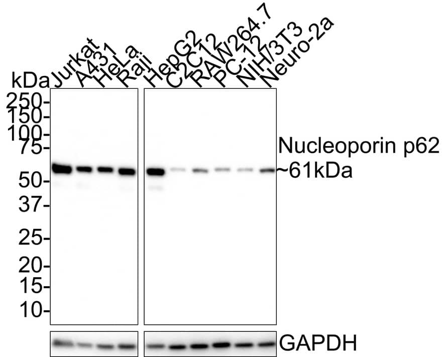 Western Blot: NUP62 Antibody (JE55-09) [NBP3-32670] - Western blot analysis of NUP62 on different lysates with Rabbit anti-NUP62 antibody (NBP3-32670) at 1/1,000 dilution. Lane 1: Jurkat cell lysate Lane 2: A431 cell lysate Lane 3: HeLa cell lysate Lane 4: Raji cell lysate Lane 5: HepG2 cell lysate Lane 6: C2C12 cell lysate Lane 7: RAW264.7 cell lysate Lane 8: PC-12 cell lysate Lane 9: NIH/3T3 cell lysate Lane 10: Neuro-2a cell lysate Lysates/proteins at 20 ug/Lane. Predicted band size: 53 kDa Observed band size: 61 kDa Exposure time: 40 seconds; 4-20% SDS-PAGE gel. Proteins were transferred to a PVDF membrane and blocked with 5% NFDM/TBST for 1 hour at room temperature. The primary antibody (NBP3-32670) at 1/1,000 dilution was used in 5% NFDM/TBST at room temperature for 2 hours. Goat Anti-Rabbit IgG - HRP Secondary Antibody at 1:100,000 dilution was used for 1 hour at room temperature.