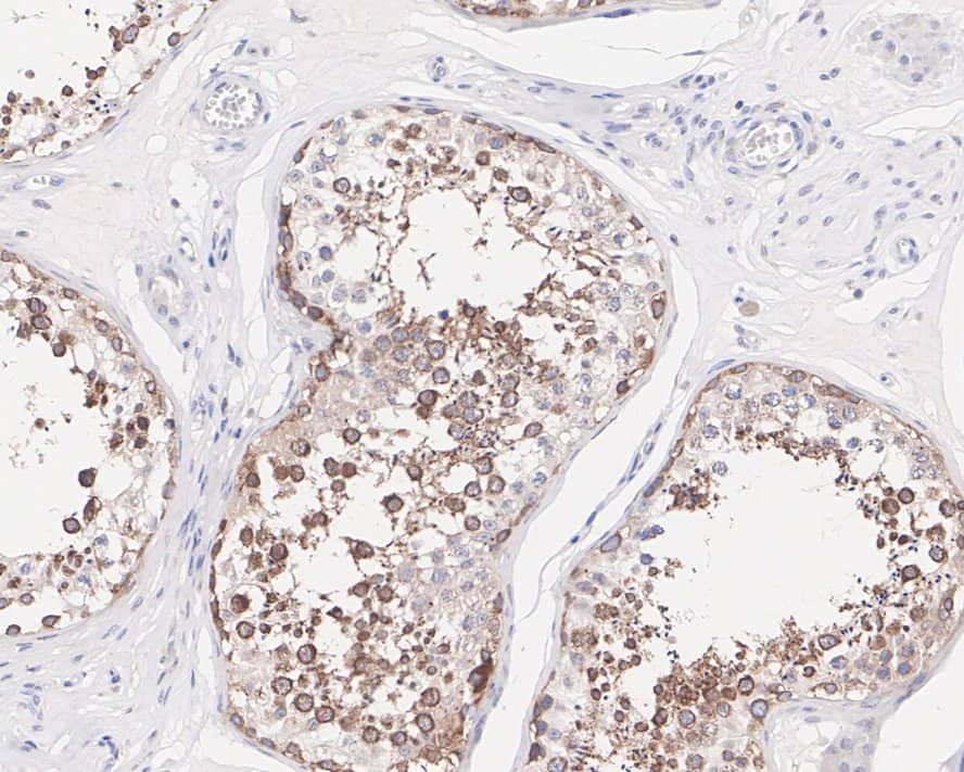 Immunohistochemistry: NUP62 Antibody (JE55-09) [NBP3-32670] - Immunohistochemical analysis of paraffin-embedded human testis tissue with Rabbit anti-NUP62 antibody (NBP3-32670) at 1/1,000 dilution. The section was pre-treated using heat mediated antigen retrieval with sodium citrate buffer (pH 6.0) for 2 minutes. The tissues were blocked in 1% BSA for 20 minutes at room temperature, washed with ddH2O and PBS, and then probed with the primary antibody (NBP3-32670) at 1/1,000 dilution for 1 hour at room temperature. The detection was performed using an HRP conjugated compact polymer system. DAB was used as the chromogen. Tissues were counterstained with hematoxylin and mounted with DPX.