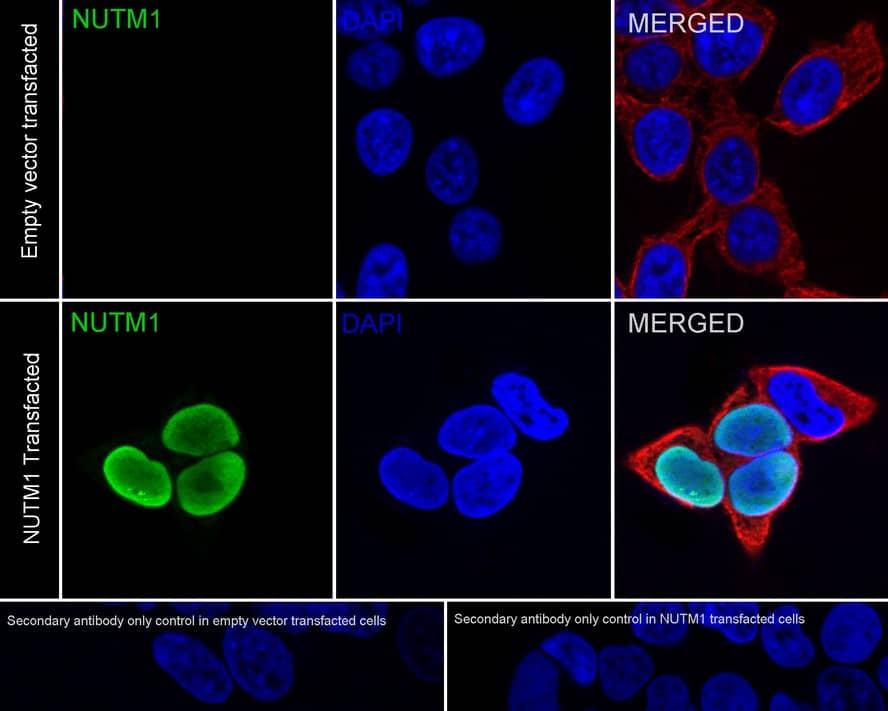 Immunocytochemistry/ Immunofluorescence: NUT Antibody [NBP3-32672] - Immunocytochemistry analysis of 293T transfacted with or without mouse NUT cells labeling Nutm1 with Rabbit anti-NUT antibody (NBP3-32672) at 1/500 dilution. Cells were fixed in 4% paraformaldehyde for 20 minutes at room temperature, permeabilized with 0.1% Triton X-100 in PBS for 5 minutes at room temperature, then blocked with 1% BSA in 10% negative goat serum for 1 hour at room temperature. Cells were then incubated with Rabbit anti-NUT antibody (NBP3-32672) at 1/500 dilution in 1% BSA in PBST overnight at 4 ℃. Goat Anti-Rabbit IgG H&L (iFluor™ 488) was used as the secondary antibody at 1/1,000 dilution. PBS instead of the primary antibody was used as the secondary antibody only control. Nuclear DNA was labelled in blue with DAPI. Beta tubulin (red) was stained at 1/100 dilution overnight at +4℃. Goat Anti-Mouse IgG H&L (iFluor™ 594) was used as the secondary antibody at 1/1,000 dilution.