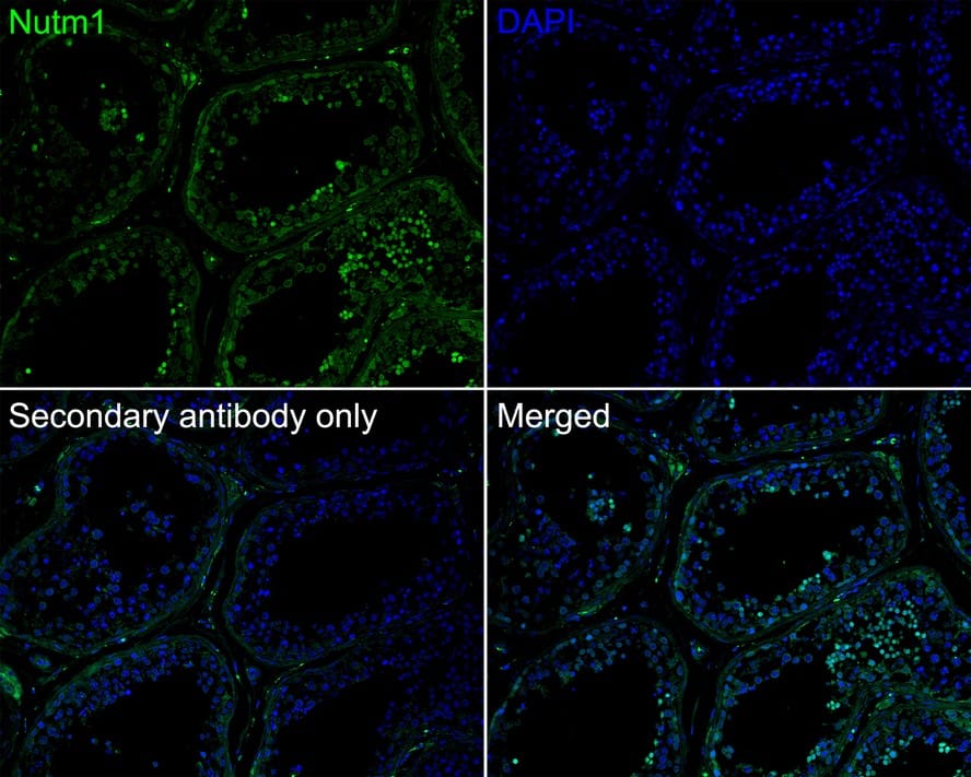 Immunohistochemistry: NUT Antibody [NBP3-32672] - Immunofluorescence analysis of paraffin-embedded human testis tissue labeling NUT with Rabbit anti-NUT antibody (NBP3-32672) at 1/200 dilution. The section was pre-treated using heat mediated antigen retrieval with sodium citrate buffer (pH 6.0) for 2 minutes. The tissues were blocked in 10% negative goat serum for 1 hour at room temperature, washed with PBS, and then probed with the primary antibody (NBP3-32672, green) at 1/200 dilution overnight at 4 ℃, washed with PBS. Goat Anti-Rabbit IgG H&L (iFluor™ 488) was used as the secondary antibody at 1/1,000 dilution. Nuclei were counterstained with DAPI (blue).