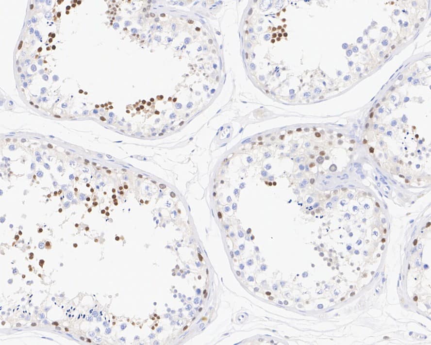 Immunohistochemistry: NUT Antibody [NBP3-32672] - Immunohistochemical analysis of paraffin-embedded human testis tissue with Rabbit anti-NUT antibody (NBP3-32672) at 1/1,000 dilution. The section was pre-treated using heat mediated antigen retrieval with sodium citrate buffer (pH 6.0) for 2 minutes. The tissues were blocked in 1% BSA for 20 minutes at room temperature, washed with ddH2O and PBS, and then probed with the primary antibody (NBP3-32672) at 1/1,000 dilution for 1 hour at room temperature. The detection was performed using an HRP conjugated compact polymer system. DAB was used as the chromogen. Tissues were counterstained with hematoxylin and mounted with DPX.