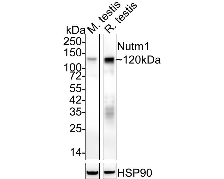 Western Blot: NUT Antibody (PSH02-78) [NBP3-32673] - Western blot analysis of NUT on different lysates with Rabbit anti-NUT antibody (NBP3-32673) at 1/2,000 dilution. Lane 1: Mouse testis tissue lysate Lane 2: Rat testis tissue lysate Lysates/proteins at 40 ug/Lane. Predicted band size: 120 kDa Observed band size: 120 kDa Exposure time: 4 minutes; 4-20% SDS-PAGE gel. Proteins were transferred to a PVDF membrane and blocked with 5% NFDM/TBST for 1 hour at room temperature. The primary antibody (NBP3-32673) at 1/2,000 dilution was used in 5% NFDM/TBST at 4  overnight. Goat Anti-Rabbit IgG - HRP Secondary Antibody at 1/50,000 dilution was used for 1 hour at room temperature.