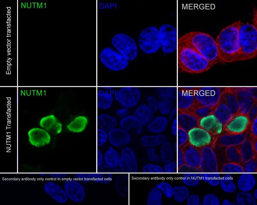 Immunocytochemistry/ Immunofluorescence: NUT Antibody (PSH02-78) [NBP3-32673] - Immunocytochemistry analysis of 293T transfacted with or without mouse NUT cells labeling Nutm1 with Rabbit anti-NUT antibody (NBP3-32673) at 1/500 dilution. Cells were fixed in 4% paraformaldehyde for 20 minutes at room temperature, permeabilized with 0.1% Triton X-100 in PBS for 5 minutes at room temperature, then blocked with 1% BSA in 10% negative goat serum for 1 hour at room temperature. Cells were then incubated with Rabbit anti-NUT antibody (NBP3-32673) at 1/500 dilution in 1% BSA in PBST overnight at 4 ℃. Goat Anti-Rabbit IgG H&L (iFluor™ 488) was used as the secondary antibody at 1/1,000 dilution. PBS instead of the primary antibody was used as the secondary antibody only control. Nuclear DNA was labelled in blue with DAPI. Beta tubulin (red) was stained at 1/100 dilution overnight at +4℃. Goat Anti-Mouse IgG H&L (iFluor™ 594) was used as the secondary antibody at 1/1,000 dilution.