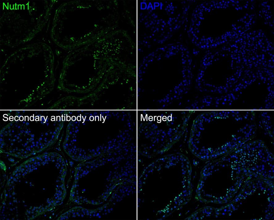 Immunohistochemistry: NUT Antibody (PSH02-78) [NBP3-32673] - Immunofluorescence analysis of paraffin-embedded human testis tissue labeling NUT with Rabbit anti-NUT antibody (NBP3-32673) at 1/200 dilution. The section was pre-treated using heat mediated antigen retrieval with sodium citrate buffer (pH 6.0) for 2 minutes. The tissues were blocked in 10% negative goat serum for 1 hour at room temperature, washed with PBS, and then probed with the primary antibody (NBP3-32673, green) at 1/200 dilution overnight at 4 ℃, washed with PBS. Goat Anti-Rabbit IgG H&L (iFluor™ 488) was used as the secondary antibody at 1/1,000 dilution. Nuclei were counterstained with DAPI (blue).