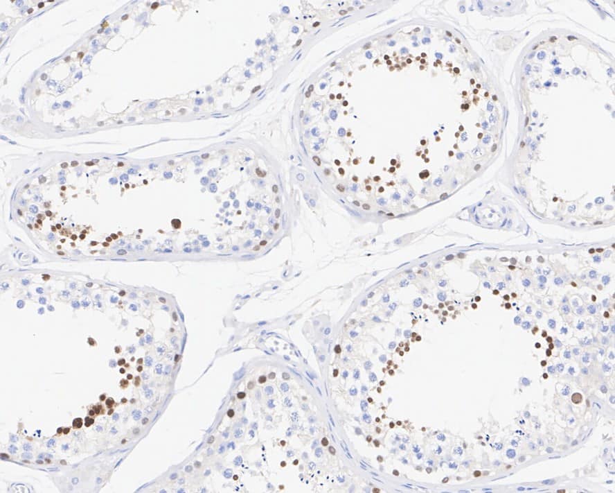 Immunohistochemistry: NUT Antibody (PSH02-78) [NBP3-32673] - Immunohistochemical analysis of paraffin-embedded human testis tissue with Rabbit anti-NUT antibody (NBP3-32673) at 1/1,000 dilution. The section was pre-treated using heat mediated antigen retrieval with sodium citrate buffer (pH 6.0) for 2 minutes. The tissues were blocked in 1% BSA for 20 minutes at room temperature, washed with ddH2O and PBS, and then probed with the primary antibody (NBP3-32673) at 1/1,000 dilution for 1 hour at room temperature. The detection was performed using an HRP conjugated compact polymer system. DAB was used as the chromogen. Tissues were counterstained with hematoxylin and mounted with DPX.