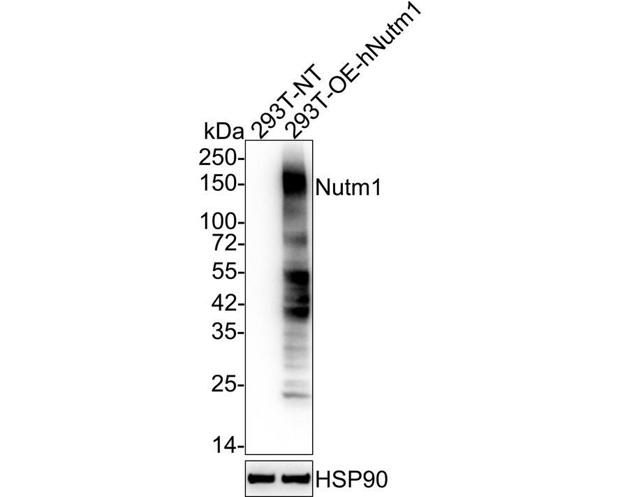 Western blot analysis on different lysates with NBP3-32674 at 1/2,000 dilution. Lane 1: 293T-NT cell lysate Lane 2: 293T-OE-hNutm1 cell lysate Lysates/proteins at 20 µg/Lane. Exposure time: 5 seconds; 4-20% SDS-PAGE gel. Proteins were transferred to a PVDF membrane and blocked with 5% NFDM/TBST for 1 hour at room temperature. NBP3-32674 at 1/2,000 dilution was used in 5% NFDM/TBST at 4℃ overnight. Goat Anti-Rabbit IgG [HRP] Secondary Antibody at 1/50,000 dilution was used for 1 hour at room temperature.