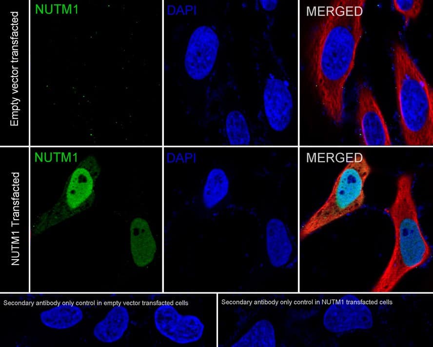 Immunocytochemistry/ Immunofluorescence: NUT Antibody (PSH03-36) [NBP3-32674] - Immunocytochemistry analysis of HeLa transfacted with or without human NUT cells labeling Nutm1 with Rabbit anti-NUT antibody (NBP3-32674) at 1/100 dilution. Cells were fixed in 4% paraformaldehyde for 20 minutes at room temperature, permeabilized with 0.1% Triton X-100 in PBS for 5 minutes at room temperature, then blocked with 1% BSA in 10% negative goat serum for 1 hour at room temperature. Cells were then incubated with Rabbit anti-NUT antibody (NBP3-32674) at 1/100 dilution in 1% BSA in PBST overnight at 4 ℃. Goat Anti-Rabbit IgG H&L (iFluor™ 488) was used as the secondary antibody at 1/1,000 dilution. PBS instead of the primary antibody was used as the secondary antibody only control. Nuclear DNA was labelled in blue with DAPI. Beta tubulin (red) was stained at 1/100 dilution overnight at +4℃. Goat Anti-Mouse IgG H&L (iFluor™ 594) was used as the secondary antibody at 1/1,000 dilution.