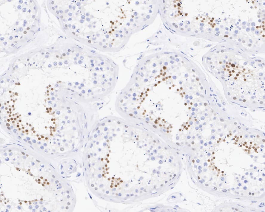 Immunohistochemistry: NUT Antibody (PSH03-36) [NBP3-32674] - Immunohistochemical analysis of paraffin-embedded human testis tissue with Rabbit anti-NUT antibody (NBP3-32674) at 1/2,000 dilution. The section was pre-treated using heat mediated antigen retrieval with sodium citrate buffer (pH 6.0) for 2 minutes. The tissues were blocked in 1% BSA for 20 minutes at room temperature, washed with ddH2O and PBS, and then probed with the primary antibody (NBP3-32674) at 1/2,000 dilution for 1 hour at room temperature. The detection was performed using an HRP conjugated compact polymer system. DAB was used as the chromogen. Tissues were counterstained with hematoxylin and mounted with DPX.