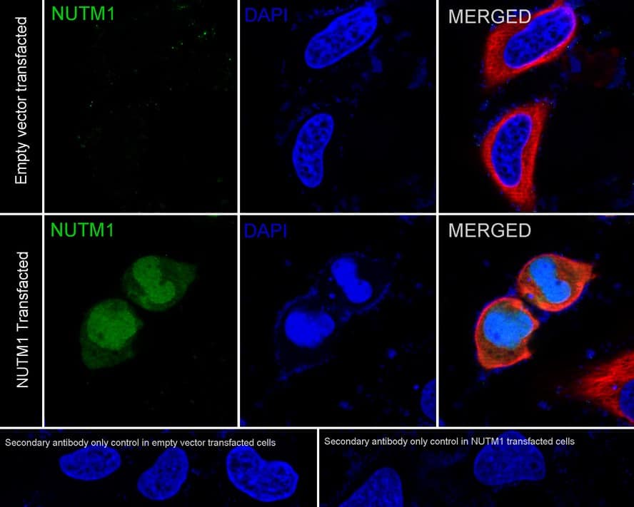 Immunocytochemistry/ Immunofluorescence: NUT Antibody (PSH03-37) [NBP3-32675] - Immunocytochemistry analysis of HeLa transfacted with or without human NUT cells labeling Nutm1 with Rabbit anti-NUT antibody (NBP3-32675) at 1/100 dilution. Cells were fixed in 4% paraformaldehyde for 20 minutes at room temperature, permeabilized with 0.1% Triton X-100 in PBS for 5 minutes at room temperature, then blocked with 1% BSA in 10% negative goat serum for 1 hour at room temperature. Cells were then incubated with Rabbit anti-NUT antibody (NBP3-32675) at 1/100 dilution in 1% BSA in PBST overnight at 4 ℃. Goat Anti-Rabbit IgG H&L (iFluor™ 488) was used as the secondary antibody at 1/1,000 dilution. PBS instead of the primary antibody was used as the secondary antibody only control. Nuclear DNA was labelled in blue with DAPI. Beta tubulin (red) was stained at 1/100 dilution overnight at +4℃. Goat Anti-Mouse IgG H&L (iFluor™ 594) was used as the secondary antibody at 1/1,000 dilution.