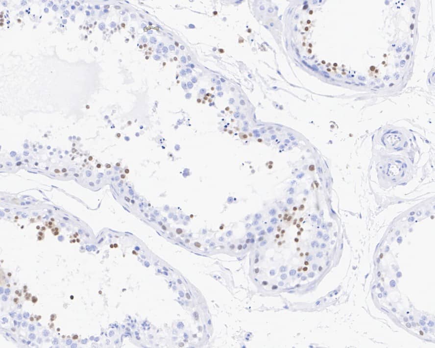 Immunohistochemistry: NUT Antibody (PSH03-37) [NBP3-32675] - Immunohistochemical analysis of paraffin-embedded human testis tissue with Rabbit anti-NUT antibody (NBP3-32675) at 1/2,000 dilution. The section was pre-treated using heat mediated antigen retrieval with sodium citrate buffer (pH 6.0) for 2 minutes. The tissues were blocked in 1% BSA for 20 minutes at room temperature, washed with ddH2O and PBS, and then probed with the primary antibody (NBP3-32675) at 1/2,000 dilution for 1 hour at room temperature. The detection was performed using an HRP conjugated compact polymer system. DAB was used as the chromogen. Tissues were counterstained with hematoxylin and mounted with DPX.