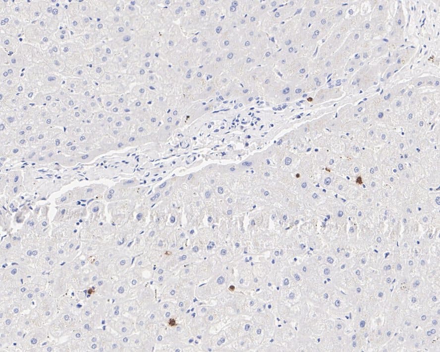 Immunohistochemistry: OLFM4 Antibody (PSH01-36) [NBP3-32677] - Immunohistochemical analysis of paraffin-embedded human liver tissue with Rabbit anti-OLFM4 antibody (NBP3-32677) at 1/500 dilution. The section was pre-treated using heat mediated antigen retrieval with Tris-EDTA buffer (pH 9.0) for 20 minutes. The tissues were blocked in 1% BSA for 20 minutes at room temperature, washed with ddH2O and PBS, and then probed with the primary antibody (NBP3-32677) at 1/500 dilution for 1 hour at room temperature. The detection was performed using an HRP conjugated compact polymer system. DAB was used as the chromogen. Tissues were counterstained with hematoxylin and mounted with DPX.