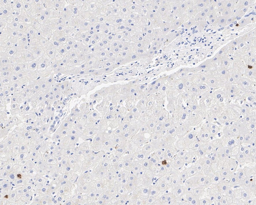 Immunohistochemistry: OLFM4 Antibody (PSH01-37) [NBP3-32678] - Immunohistochemical analysis of paraffin-embedded human liver tissue with Rabbit anti-OLFM4 antibody (NBP3-32678) at 1/100 dilution. The section was pre-treated using heat mediated antigen retrieval with Tris-EDTA buffer (pH 9.0) for 20 minutes. The tissues were blocked in 1% BSA for 20 minutes at room temperature, washed with ddH2O and PBS, and then probed with the primary antibody (NBP3-32678) at 1/100 dilution for 1 hour at room temperature. The detection was performed using an HRP conjugated compact polymer system. DAB was used as the chromogen. Tissues were counterstained with hematoxylin and mounted with DPX.