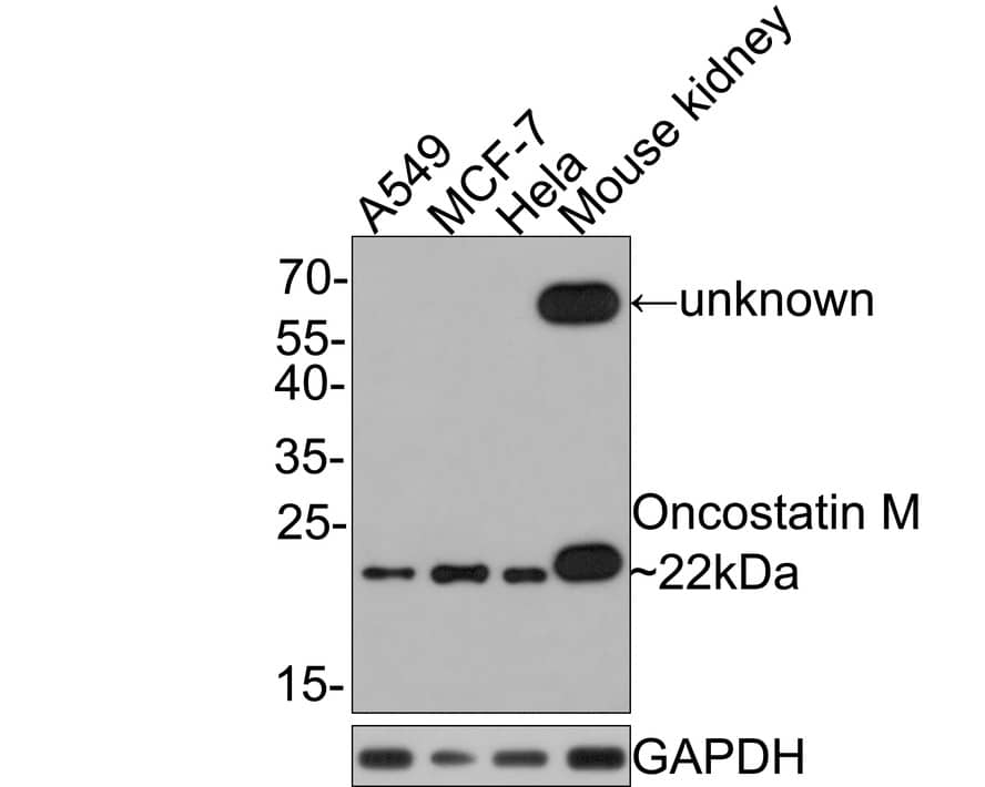 Western blot analysis on different lysates with NBP3-32679 at 1/500 dilution. Lane 1: A549 cell lysate Lane 2: MCF-7 cell lysate Lane 3: Hela cell lysate Lane 4: Mouse kidney tissue lysate (20 µg/Lane) Lysates/proteins at 10 µg/Lane. Predicted band size: 28 kDa Observed band size: 22 kDa Exposure time: 2 minutes; 12% SDS-PAGE gel. Proteins were transferred to a PVDF membrane and blocked with 5% NFDM/TBST for 1 hour at room temperature. NBP3-32679 at 1/500 dilution was used in 5% NFDM/TBST at room temperature for 2 hours. Goat Anti-Rabbit IgG [HRP] Secondary Antibody at 1:300,000 dilution was used for 1 hour at room temperature.